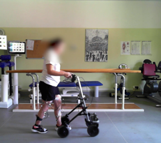 Paralizzata dopo un incidente sportivo, una 32enne è tornata a camminare dopo l'impianto di un neurostimolatore midollare al San Raffaele di Milano