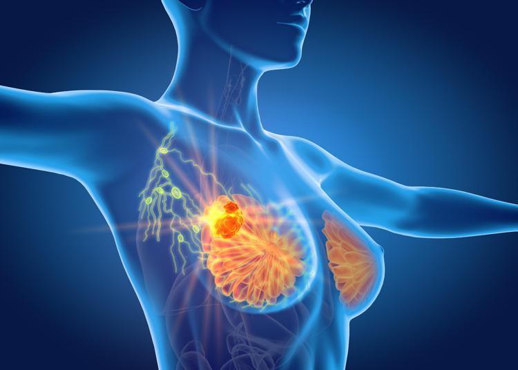 Per cancro seno la cura che arriva dal gelo, Ieo: 