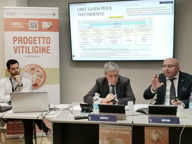 Vitiligine, in Lombardia oltre 60mila persone convivono con la malattia. La ricerca fa passi avanti ma è importante costruire percorsi di presa in carico dei pazienti