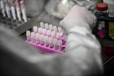Test virus in provetta - Afp