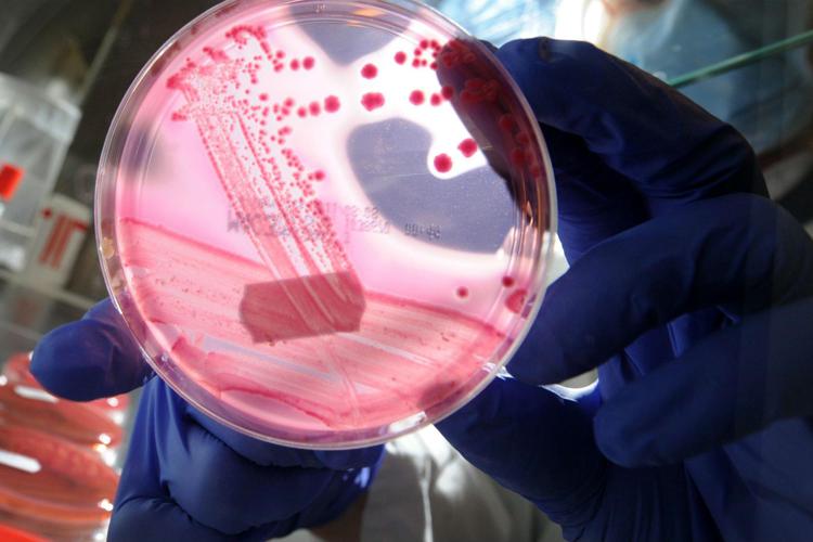 Il batterio dell'Escherichia coli  - (Fotogramma)