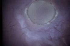 Spermatozoi e ovulo (Fotogramma)