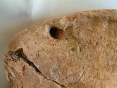 Segno di dente di leone sull'osso dell'anca - Maynooth University
