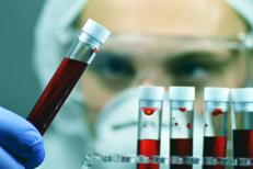 Provette di sangue