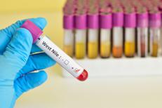 Esami per la West  Nile (123Rf)