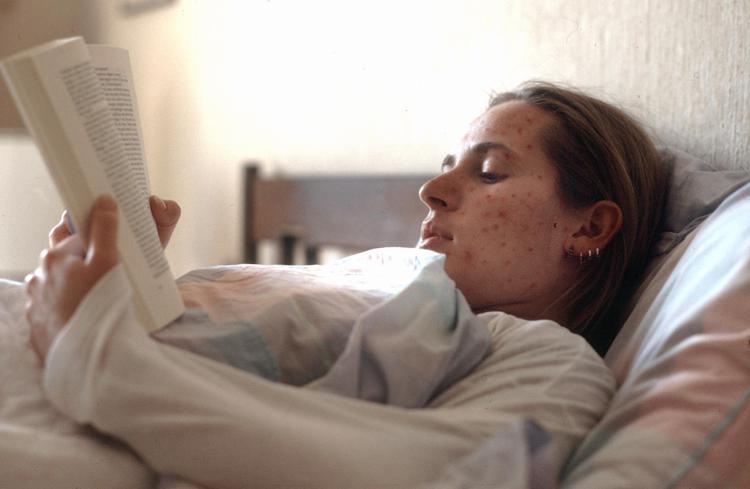 Ragazza con il morbillo - (IPa)